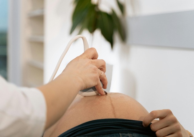 Control embaràs - reproduccio